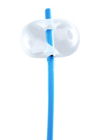 Balón extractor de cálculos biliares