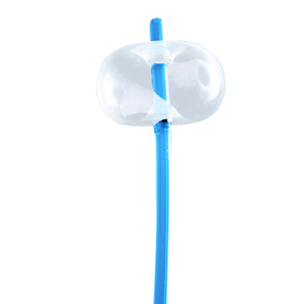 Balón extractor de cálculos biliares